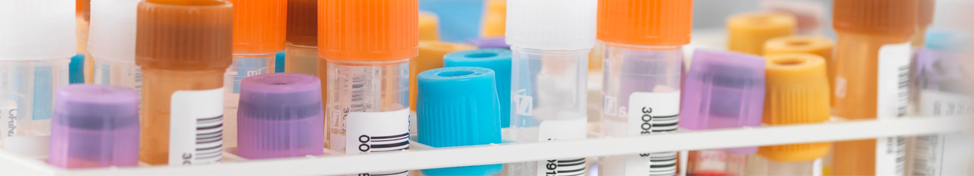 Ovi Clinic Medecine Augmentee Outils Diagnostic Biomarqueurs Performance