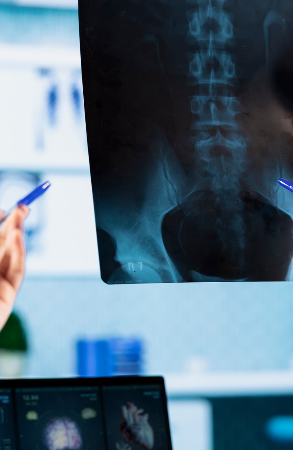 Ovi Clinic Specialite Orthopedie Et Traumatologie Appareil Locomoteur